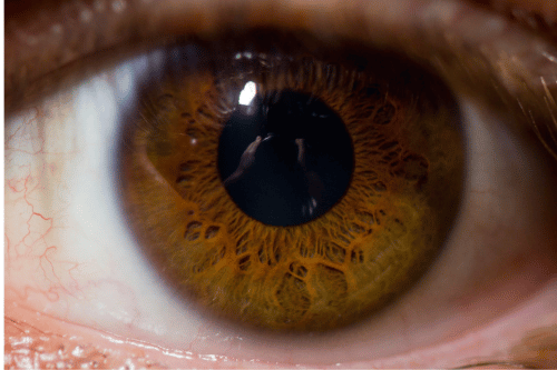 brainspotting vs emdr